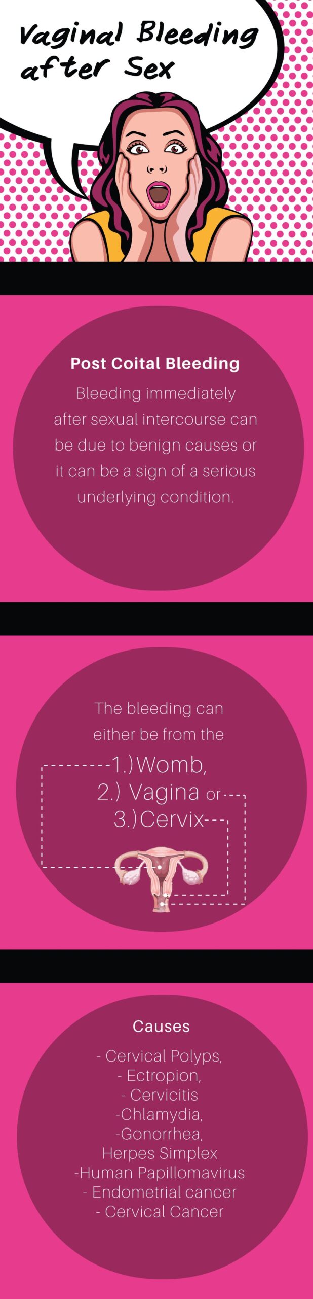 The Causes Of Vaginal Bleeding After Sex Post Coital Bleeding 7444